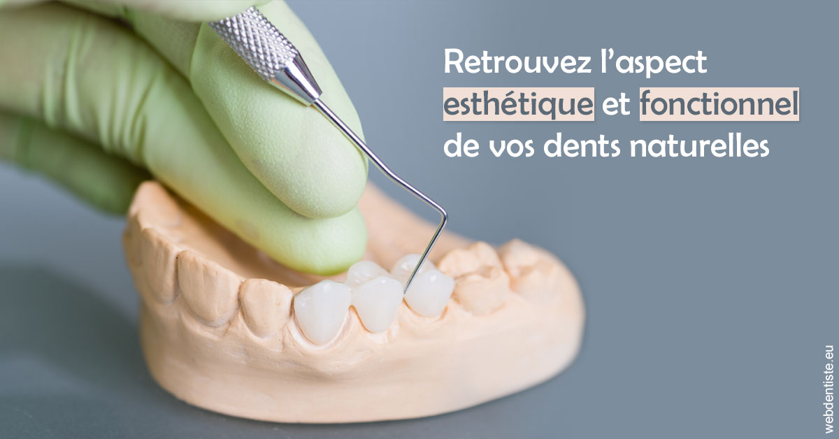 https://dr-hueber-veronique.chirurgiens-dentistes.fr/Restaurations dentaires 1