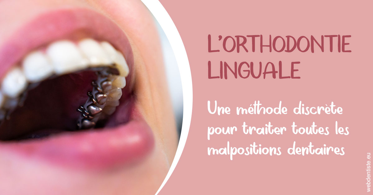 https://dr-hueber-veronique.chirurgiens-dentistes.fr/L'orthodontie linguale 2