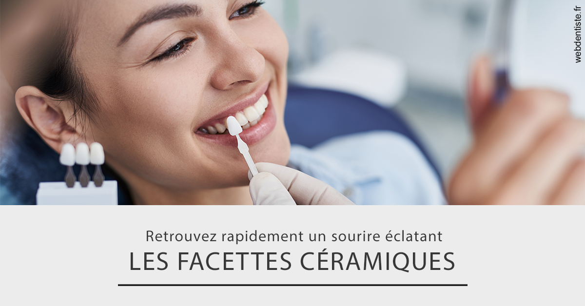https://dr-hueber-veronique.chirurgiens-dentistes.fr/Les facettes céramiques 2