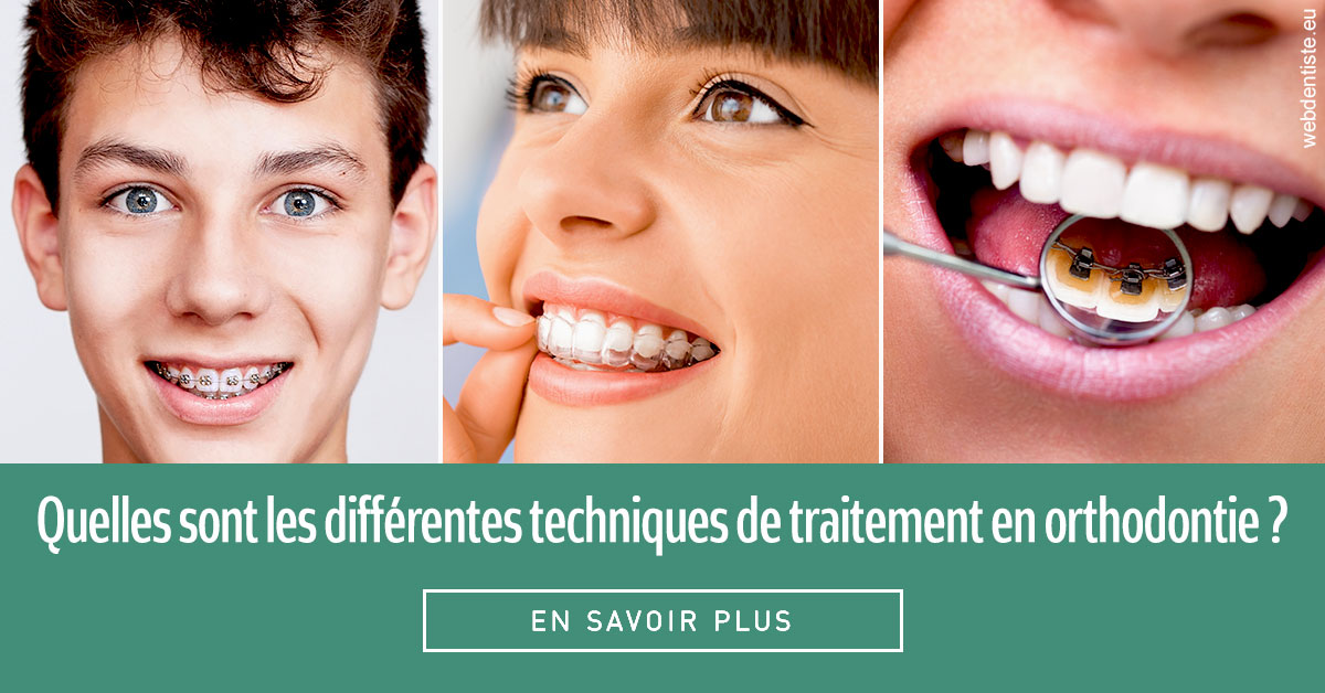 https://dr-hueber-veronique.chirurgiens-dentistes.fr/Les différentes techniques de traitement 2