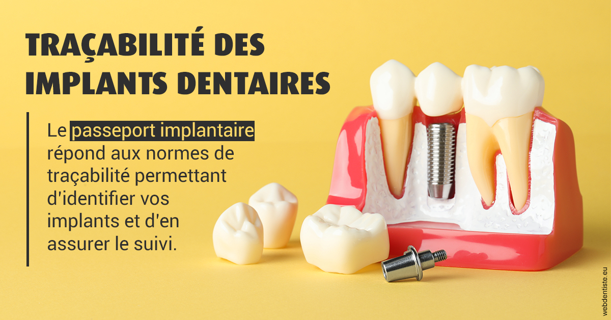 https://dr-hueber-veronique.chirurgiens-dentistes.fr/T2 2023 - Traçabilité des implants 2
