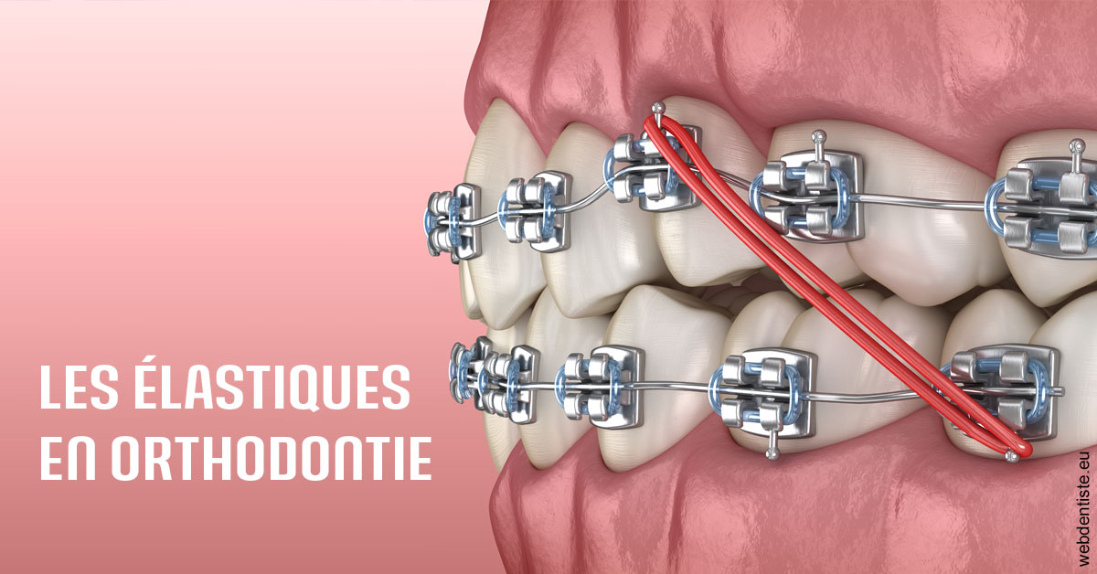 https://dr-hueber-veronique.chirurgiens-dentistes.fr/Elastiques orthodontie 2