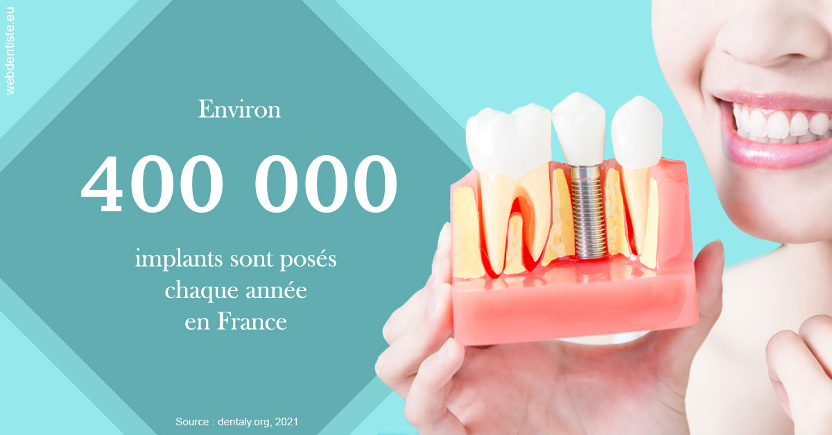 https://dr-hueber-veronique.chirurgiens-dentistes.fr/Pose d'implants en France 2