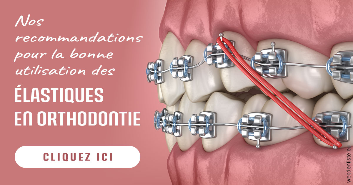 https://dr-hueber-veronique.chirurgiens-dentistes.fr/Elastiques orthodontie 2